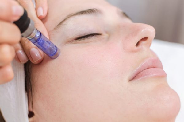 How Does The Dermapen Work? Unveiling The Science Behind Micro-needling